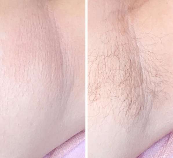 Шугаринг(модели) в Ростове-на-Дону