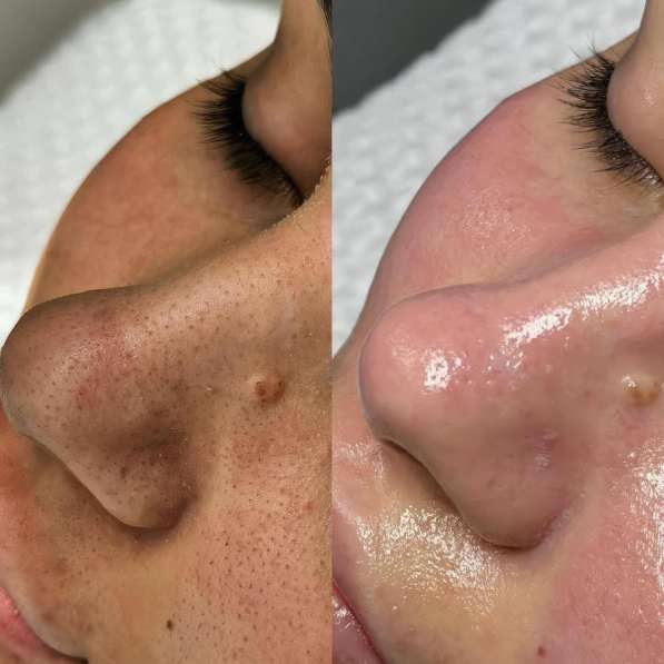 Косметолог эстет в Грозном фото 8