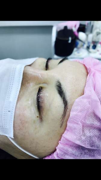 Косметологии Депиляция в Москве фото 3