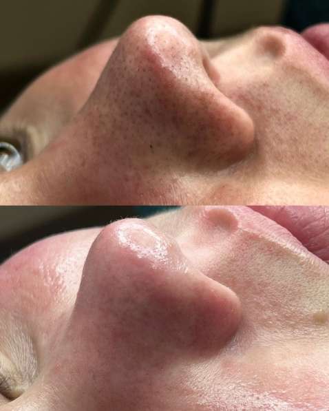 Косметолог эстет в Грозном