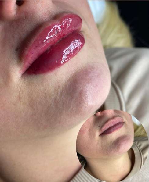 Косметолог, губы в Щелково фото 4