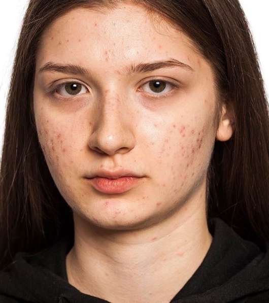Почищу ваши фото от изъянов